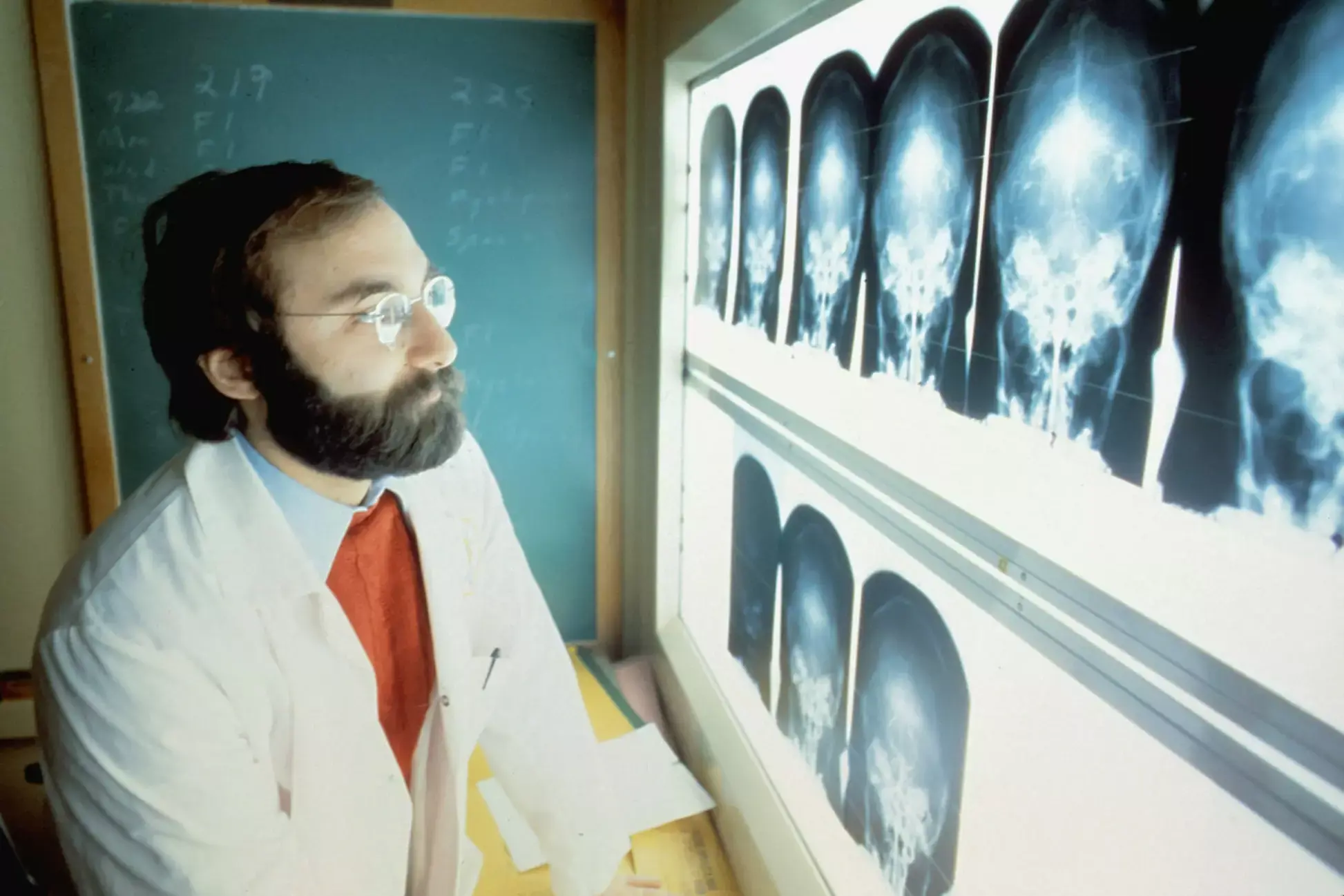 Le médecin observe les radiographies.